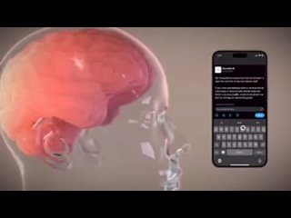 elon musk said that the first person with a brain implant from neuralink has fully recovered and can now control computers.